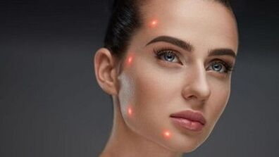 Mi a frakcionált bőrfiatalítás