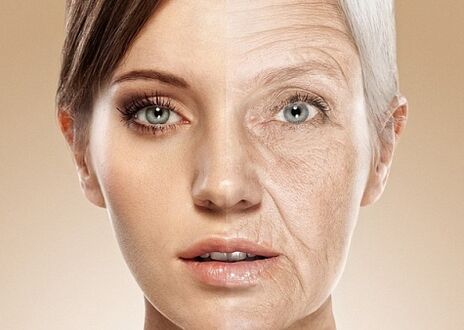 lézeres arcbőrfiatalítás előtt és után