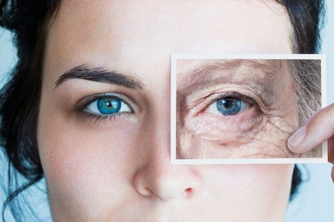 a szem körüli bőr hogyan lehet megfiatalítani